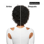 Metal Detox Pre-Tratamiento Anti-Porosidad