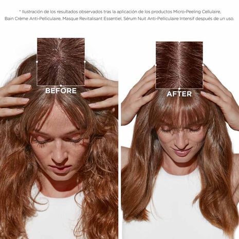 MICRO - PEELING CELLULAIRE